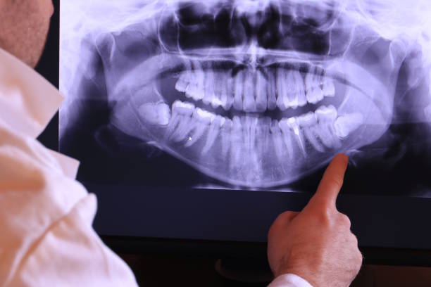 Best Emergency TMJ Treatment in Hill N Dale, FL