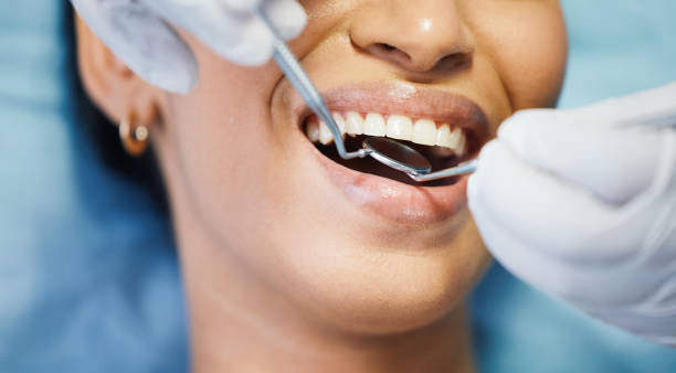Best Emergency Wisdom Teeth Removal in Hill N Dale, FL