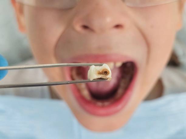 Best Same-Day Emergency Dental Services in Hill N Dale, FL