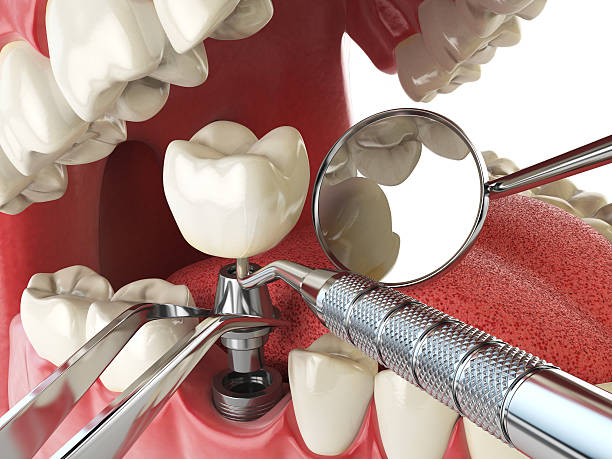 Best Cosmetic Emergency Dentistry in Hill N Dale, FL